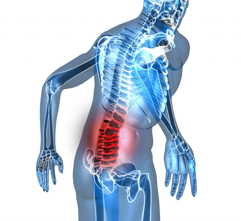 Recommend your patients to continue sticking to a healthy diet, taking appropriate supplements, exercising, getting enough sleep, and reducing stress — all critical for retaining the improvements with gut health and low back pain