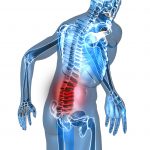 Gut health and low back pain: the chiropractic approach with nutritional testing
