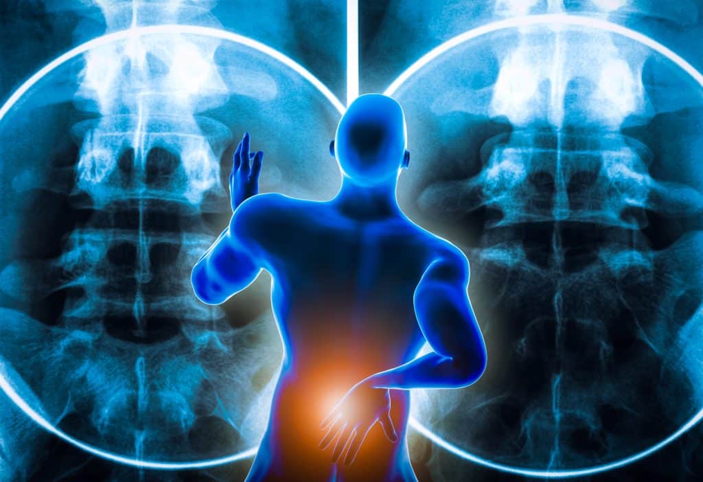 The rapidly-changing personal injury chiropractic landscape and how it is impacting DCs