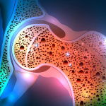 Does your patient have low bone density? Why to utilize DXA scanning