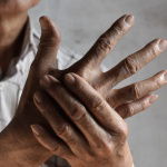 An alternative for treating arthritis